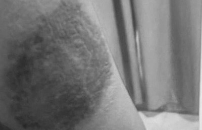 އަނިޔާއަށް ފަހު ދަރިން އަތުލި މައެއްގެ އާދޭސް!