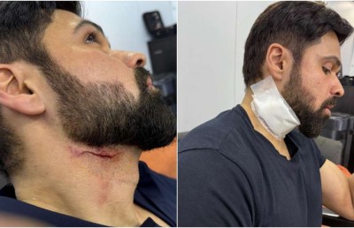 ފިލްމެއްގެ ޝޫޓިންގައި އިމްރާން ހާޝްމީއަށް އަނިޔާވެއްޖެ