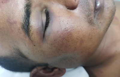 ސިފައިންގެ މީހާ އަށް ހުރީ ވަރަށް ބޮޑަށް އަނިޔާކޮށްފައި