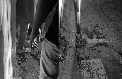 ނުރައްކާތެރި އެކްސިޑެންޓެއްގައި ޗިސްވި ފައި ބުރިކޮށްލި