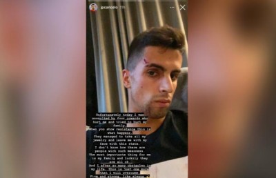 މެންޗެސްޓާ ސިޓީގެ ތަރިއަކަށް ވަގުންތަކެއް ހަމަލާ ދީފި