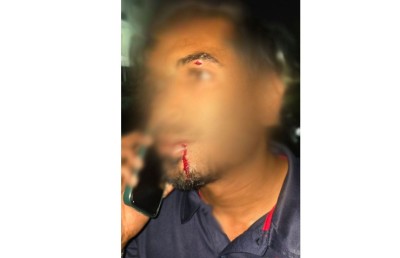 މުވައްޒަފުންނަށް ކުރިމަތިވާ ނުރައްކާތައް ސީރިއަސް ކަމެއްގެ ގޮތުގައި ބަލާނަން: ފަހުމީ