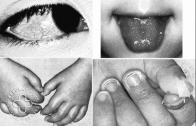 މިސްކް ޖެހުނު ކުއްޖަކު ނިޔާ ވެސް ވެއްޖެ، މިހާރު ފެންނަ އަލާމާތްތައް ތަފާތު