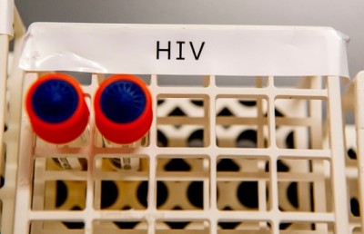 ސްޓެމް ސެލްގެ ފަރުވާއިން އެޗްއައިވީން ސަލާމަތް ވެއްޖެ