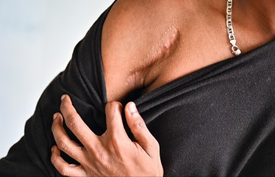 ފައި ބުރިކޮށްލުމުން ލިބުނު ހިތްވަރުގައި ހިނގަނީ މާ ބާރަށް