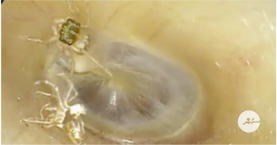 އާދަޔާ ޚިލާފު އަޑުތަކެއް އިވޭތީ ޑޮކްޓަރަށް ދެއްކުމުން ކަންފަތުން ފެނުނީ ވާމަކުނެއް