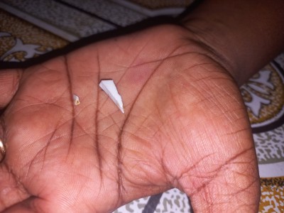 ހެދިކާ ތެރޭ އޮތް ފުޅިތޮށިގަނޑެއް ކެވި، ކުޑަކުއްޖަކަށް އަނިޔާވެއްޖެ