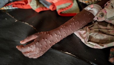 މަކުނު ވިދުރި ކޮންޓްރޯލެއް ނުވޭ: އެފްރިކާ ސީޑީސީ