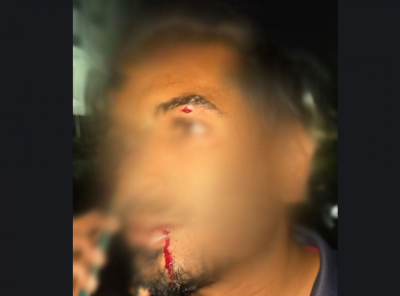 ޓްރާންސްފޯމަރަކުން ވައްކަން ކުރަން އުޅުނު މީހަކު ހުއްޓުވުމުގެ ތެރޭ، ރެންޗަކުން ސްޓެލްކޯގެ މުވައްޒަފެއްގެ ބޯފަޅާލައިފި