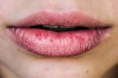 ތުންފަތް މާބޮޑަށް ހިކި ފަޅައިގެންދާނަމަ މި ކަންކަން ކޮށްލާ