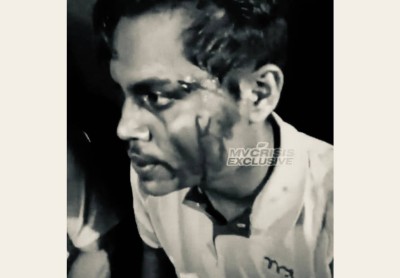 މާލޭގައި ދެ ބިދޭސީއަކު މާރާމާރީ ހިންގައި، އެކެއްގެ ބޯ ފަޅާލައިފި