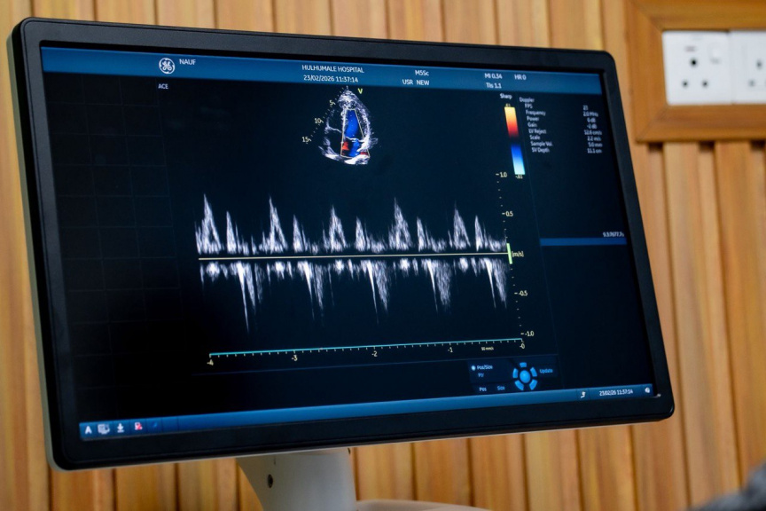 ހުޅުމާލެ ހޮސްޕިޓަލުގައި ހިތުގެ ބަލިތައް ދެނެގަންނަ އެންމެ ޒަމާނީ އިމޭޖިންގް ޓެކްނޮލޮޖީ ބޭނުންކުރަން ފަށައިފި