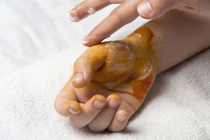 ފިހިގެން ކުއްލި ފަރުވާ ހޯދުން: ކުރަންވީ އަދި ނުކުރަންވީ ކަންތައްތައް