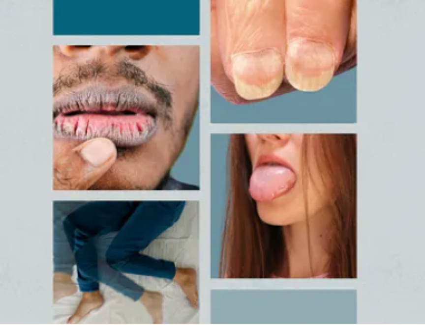 ހަށިގަނޑުގައި ރައްކާކުރެވިފައި ހުންނަ ދަގަނޑުގެ މިންވަރު މަދުވުން: ސަމާލުކަން ނުދެވޭ ކަމެއް